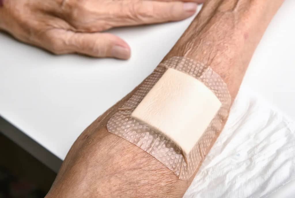 Choosing the Right Wound Dressing